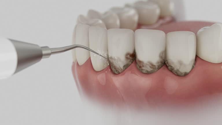 Trusted Teeth Whitening service in Linton Hall, VA - Dentist Open Now